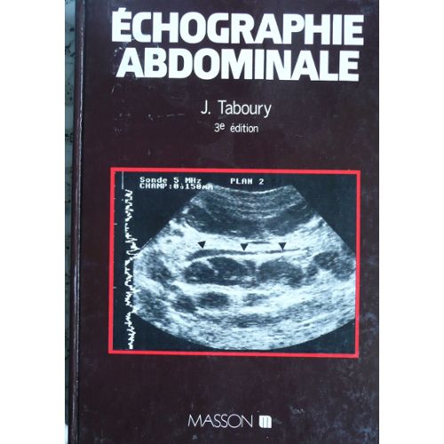 prix echographie abdominale 2
